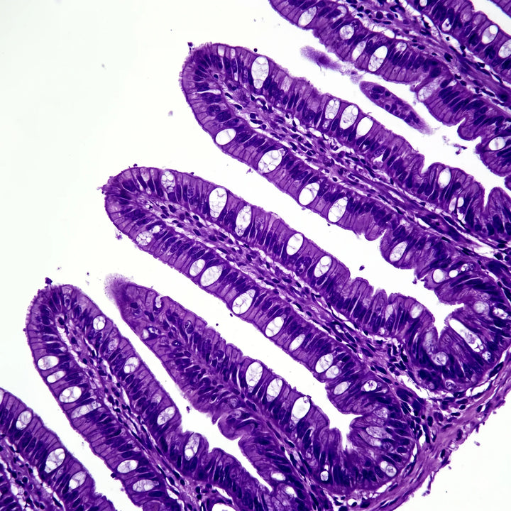 Histologischer Querschnitt von Darmzotten (Villi) unter dem Lichtmikroskop. Darm-Hirn-Achse.