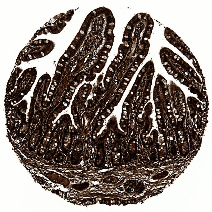 Histologischer Querschnitt der Darmwand mit Villi und Mukosaschicht unter dem Lichtmikroskop.