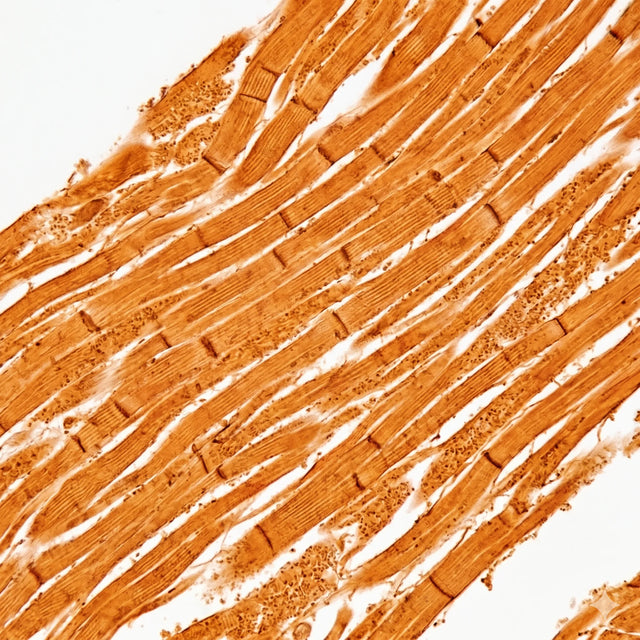 Histologischer Querschnitt von Herzmuskelgewebe mit dicht gepackten Mitochondrien unter dem Lichtmikroskop.