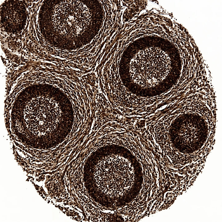Histologischer Querschnitt von Lymphknotengewebe mit Immunzellclustern unter dem Lichtmikroskop.