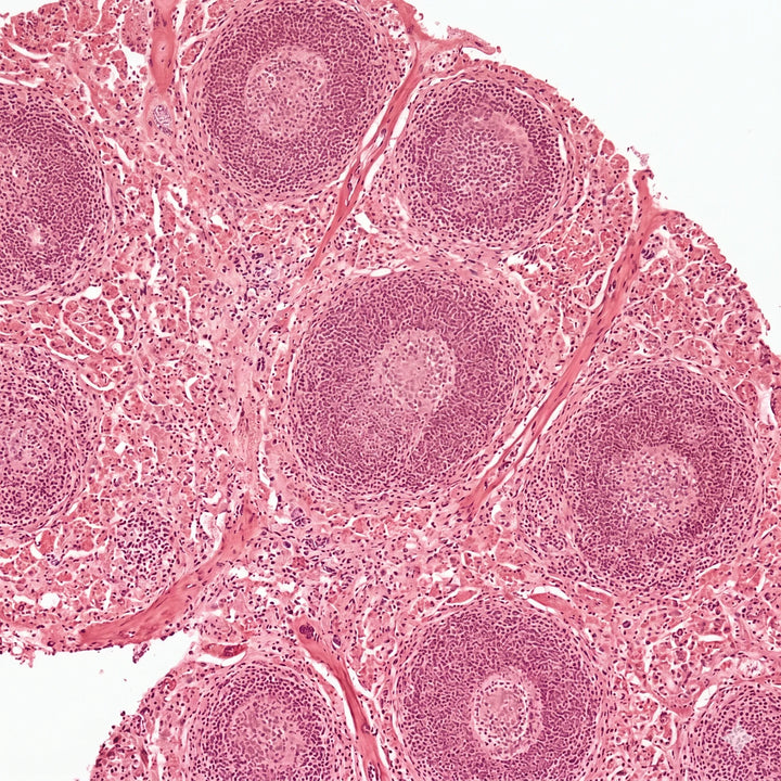 Histologischer Querschnitt von Milzgewebe mit Immunzellclustern unter dem Lichtmikroskop.