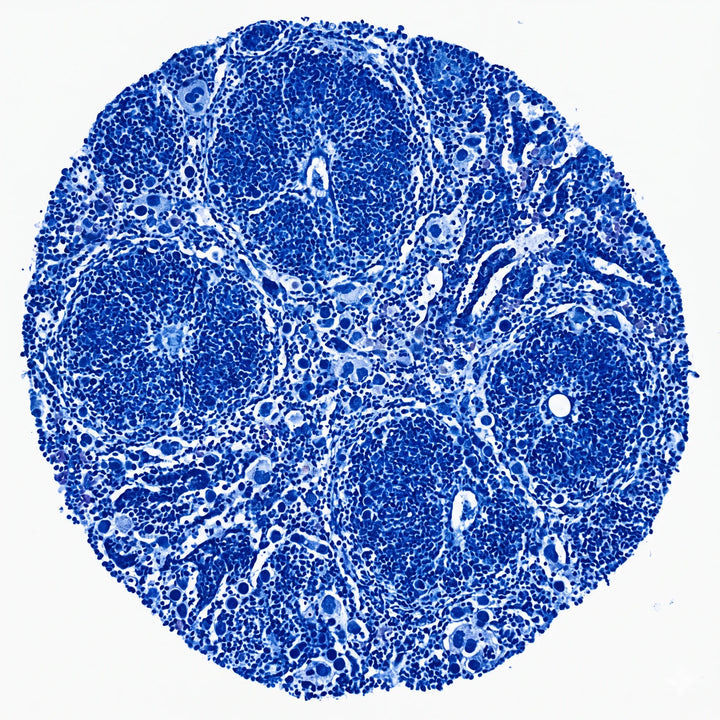 Histologischer Querschnitt von Milzgewebe mit Immunzellclustern unter dem Lichtmikroskop.