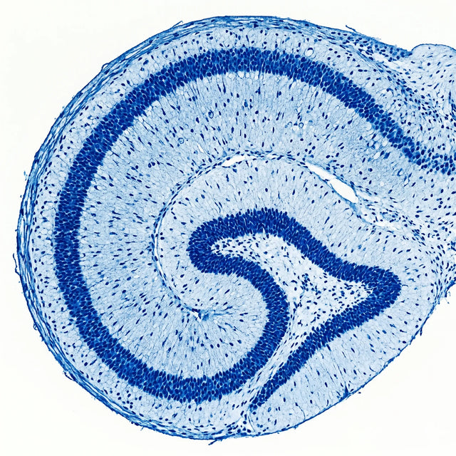 Histologischer Querschnitt des Hippocampus mit Pyramidenzellen unter dem Lichtmikroskop.